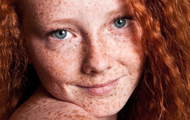Celts' red hair could attributed to the cloudy weather |